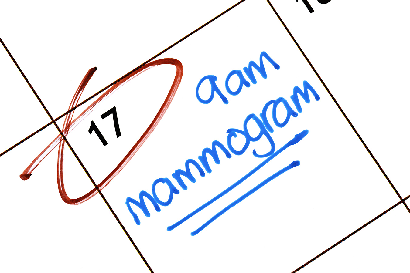contrast enhanced mammography