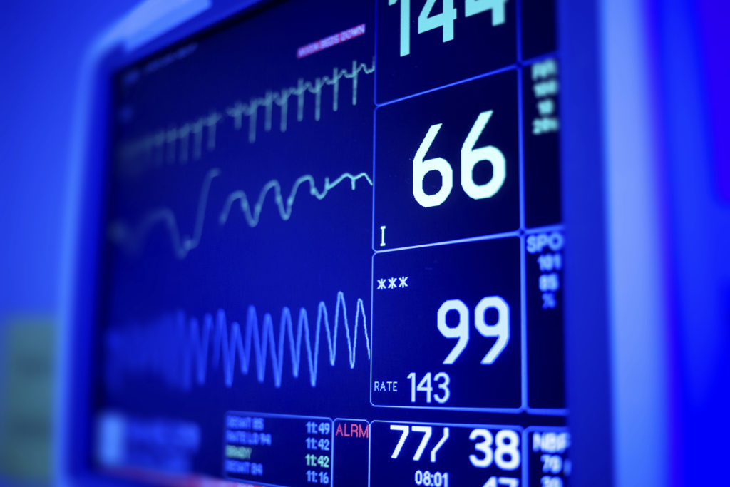 Close image of heart monitor